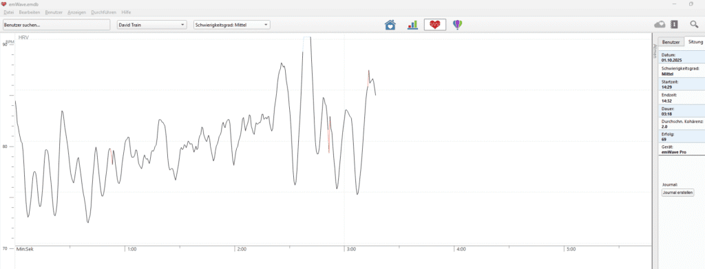 HRV-Kurve mit Zeichen von Inkohärenz – aufgezeichnet mit dem HeartMath emWave Pro. Die unregelmäßigen Schwankungen zeigen, wie Herz und Nervensystem unter Stress nicht synchron arbeiten. Beispiel für Inkohärenz im Vergleich zu kohärenter Herzkohärenz